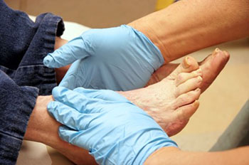 diabetic foot treatment in the Arlington, TX 76013 area