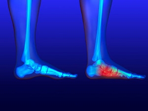 Babies, Children, and Flat Feet