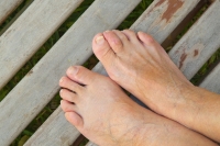 What Are the Signs of Hammertoe?
