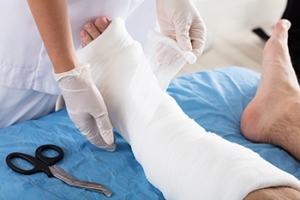 When a Total Contact Cast Is Needed