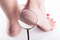 Can Medical Conditions Cause Cracked Heels?