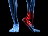 Common Causes and Treatments for Heel Pain